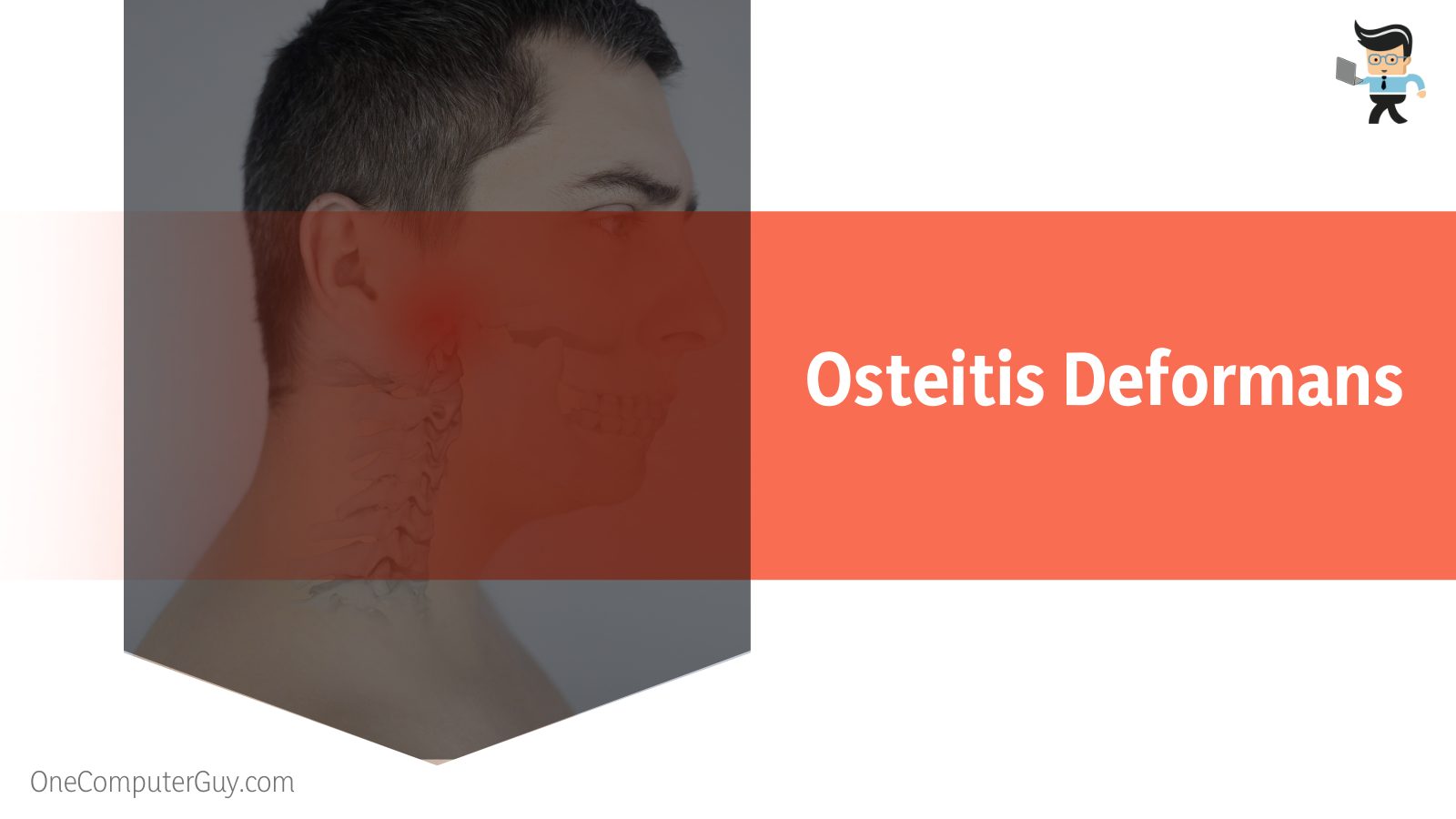 Osteitis Deformans